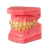 Evodent Orthodontic Model Half Metal And Half Ceramic Bracket