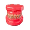 Evodent Orthodontic Model Metal Bracket