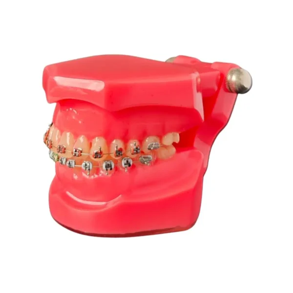 Evodent Orthodontic Model Metal Bracket