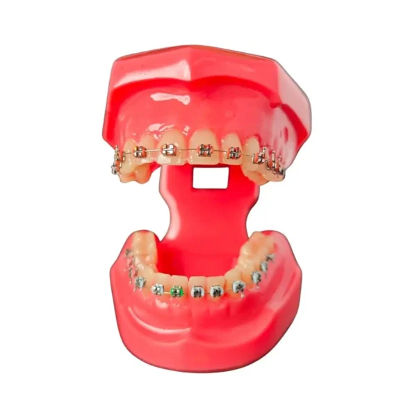 Evodent Orthodontic Model Metal Bracket
