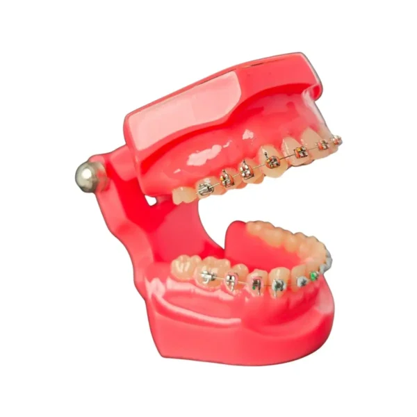 Evodent Orthodontic Model Metal Bracket