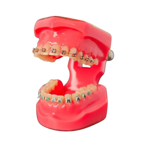 Evodent Orthodontic Model Metal Bracket
