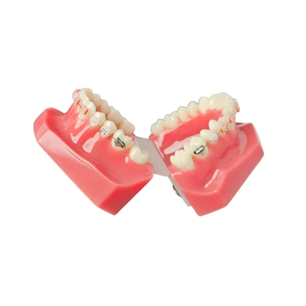 Evodent Orthodontic Model With Ceramic Bracket, Pink