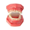 Evodent Orthodontic Model With Ceramic Bracket, Pink