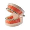 Evodent Orthodontic Model With Metal Bracket 4 Evodent Orthodontic Model With Metal Bracket