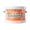 Evodent Orthodontic Model With Metal Bracket 2 Evodent Orthodontic Model With Metal Bracket