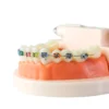 Evodent Orthodontic Model With Metal Bracket 6