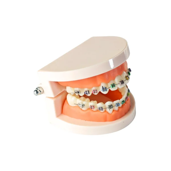 Evodent Orthodontic Model with Metal Bracket