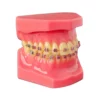 Evodent Orthodontic Model With Metal Bracket, Pink