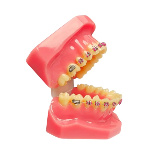 Evodent Orthodontic Model with Metal Bracket, Pink