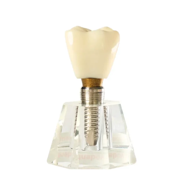 Evodent Three Part Implant Model with Clear Base