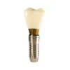 Evodent Two Part Implant Model With Clear Base
