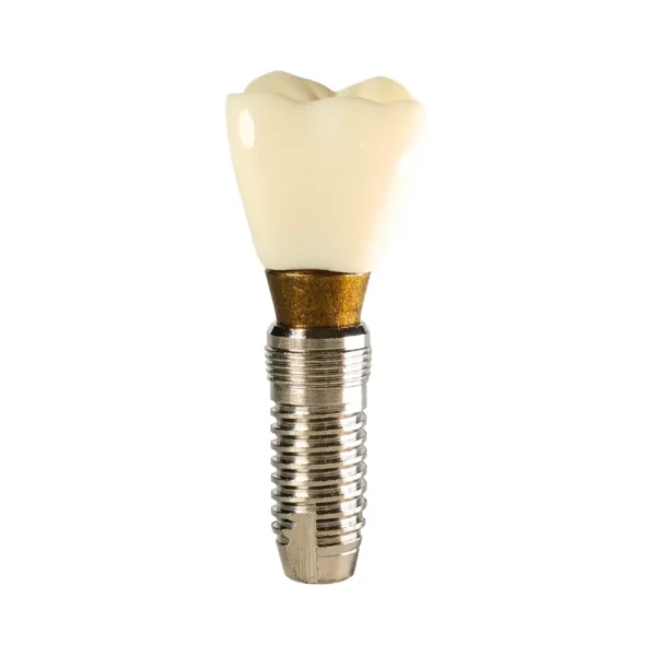 Evodent Two Part Implant Model with Clear Base