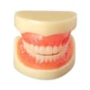 Evodent Full Denture With Implant Model