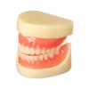 Evodent Full Denture With Implant Model