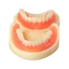 Evodent Full Denture With Implant Model