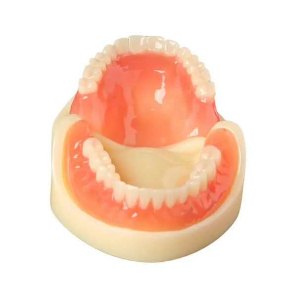 Evodent Full Denture with Implant Model