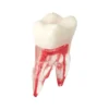 Evodent Root Canal Treatment Practice Model