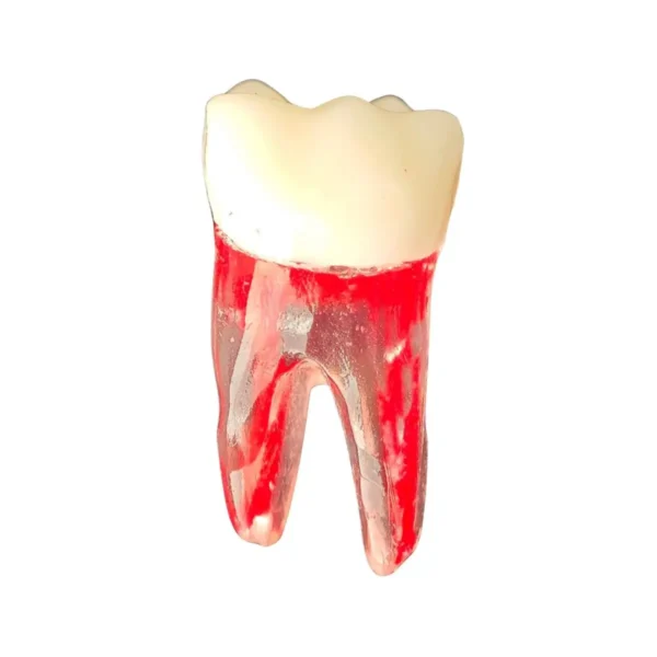 Evodent Root Canal Treatment Practice Model