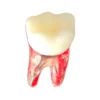 Evodent Root Canal Treatment Practice Model