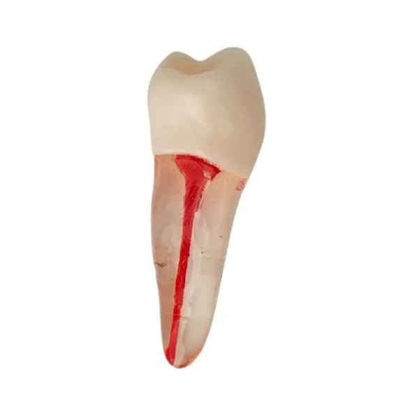 Root Canal Treatment Practice Model