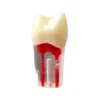 Evodent Root Canal Treatment Practice Model