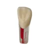 Evodent Root Canal Treatment Practice Model