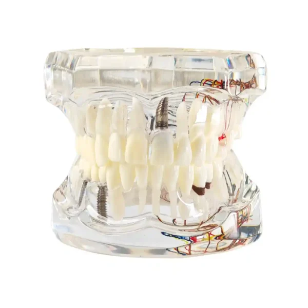 Evodent All in One with Nerve Supply