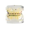 Evodent Orthodontic Demonstration Model With Metal Braces, Archwire And Power Chain
