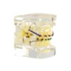 Evodent Orthodontic Demonstration Model With Metal Braces, Archwire And Power Chain