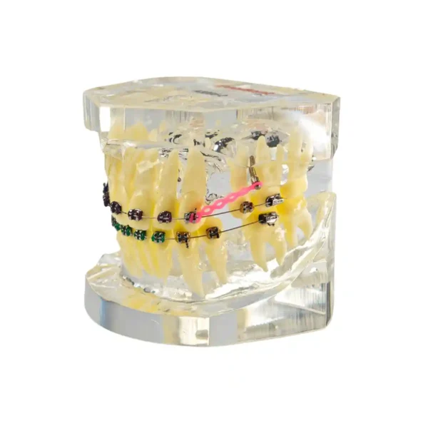 Evodent Orthodontic Demonstration Model with Metal Braces, Archwire and Power Chain