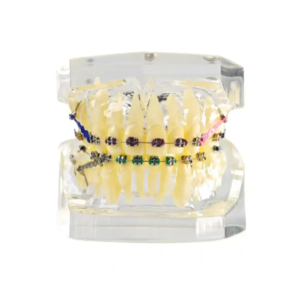Evodent Orthodontic Demonstration Model with Metal Braces, Archwire and Power Chain