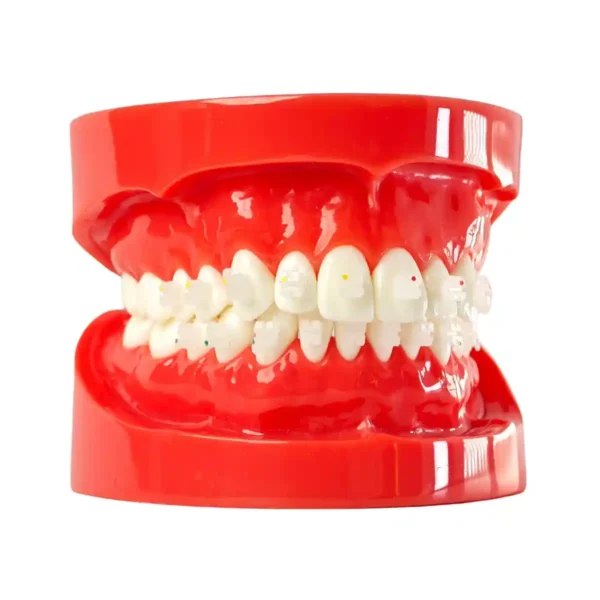 Evodent Orthodontic Model with Ceramic Bracket