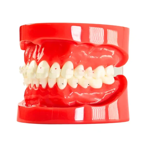 Evodent Orthodontic Model with Ceramic Bracket