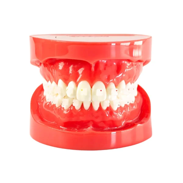 Evodent Orthodontic Model with Ceramic Bracket