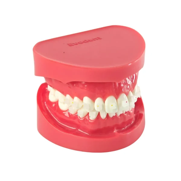 Evodent Orthodontic Model with Ceramic Bracket
