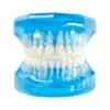 Evodent Orthodontic Model With Ceramic Bracket, Blue