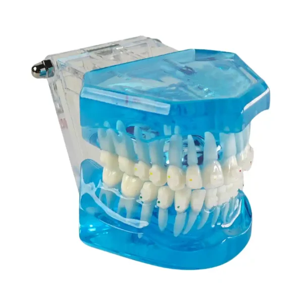 Evodent Orthodontic Model with Ceramic Bracket, Blue