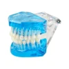 Evodent Orthodontic Model With Ceramic Bracket, Blue