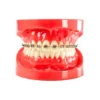 Evodent Orthodontic Braces Vs Aligners Comparison Model For Patient Education (Fixed Appliances Vs Clear Aligners)