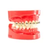 Evodent Orthodontic Braces Vs Aligners Comparison Model For Patient Education (Fixed Appliances Vs Clear Aligners)