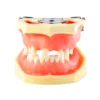 Evodent Sinus Lift With Implant Practice Model