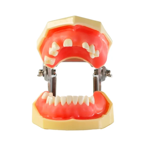 Evodent Sinus Lift with Implant Practice Model