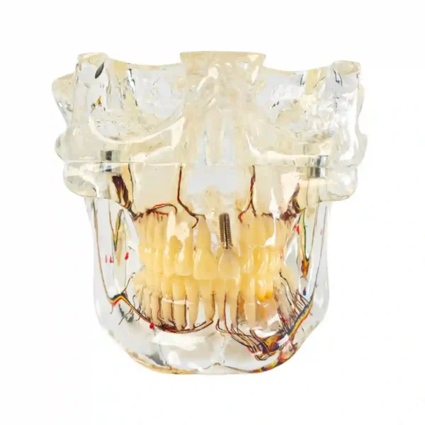 Evodent Signature Orthodontic and Osteology Model for TMJ Anatomy, Jaw Movement, Maxillofacial and Maxillary Sinus
