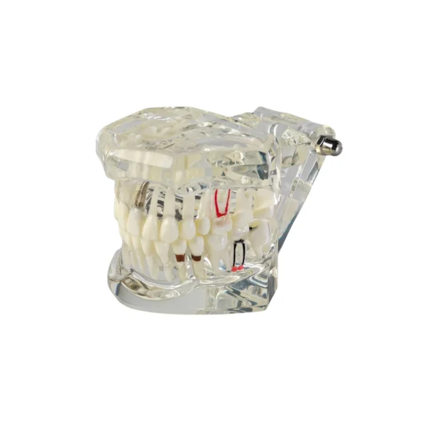 Evodent Signature All in One With Pathology and Implant Clear