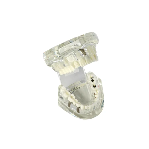 Evodent Signature All in One With Pathology and Implant Clear