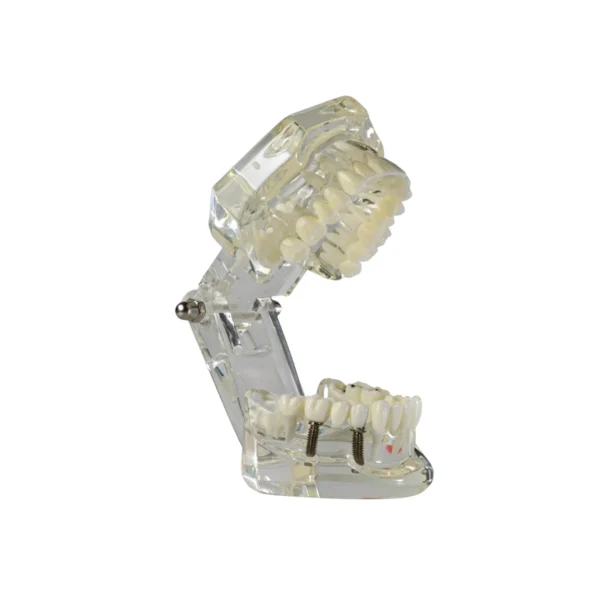 Evodent Signature All in One With Pathology and Implant Clear