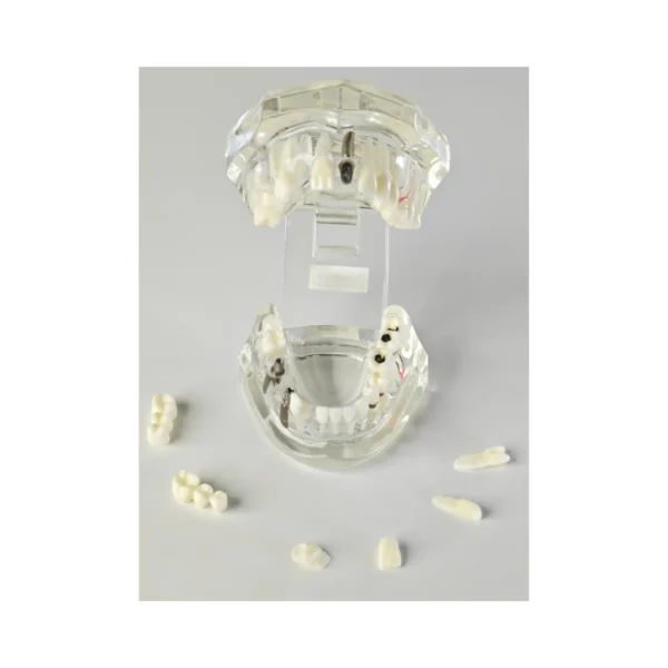 Evodent Signature All in One With Pathology and Implant Clear