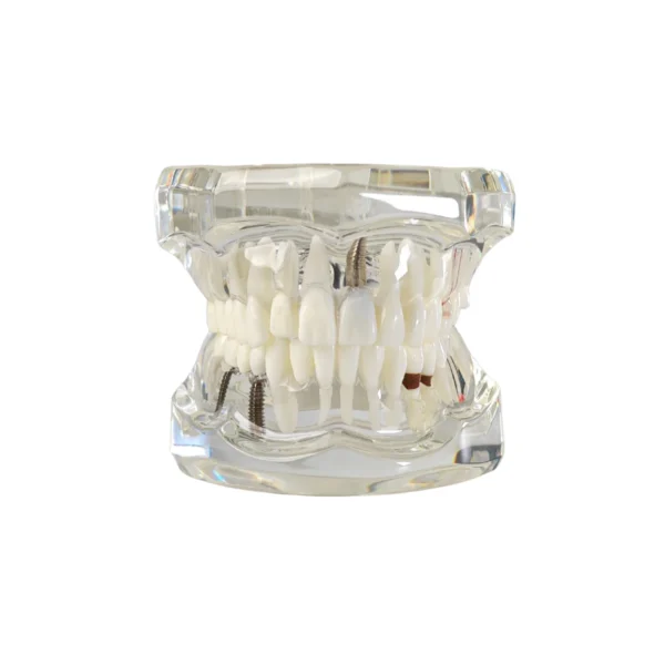 Evodent Signature All in One With Pathology and Implant Clear
