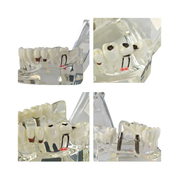 Evodent Signature All in One With Pathology and Implant Clear